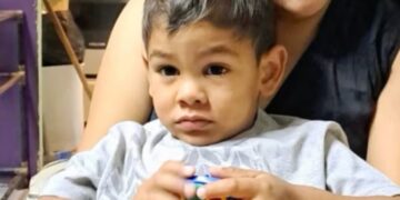 Dos bebés internados con fractura de cráneo en un hospital público, el caso Ángel y la cifra que alarma